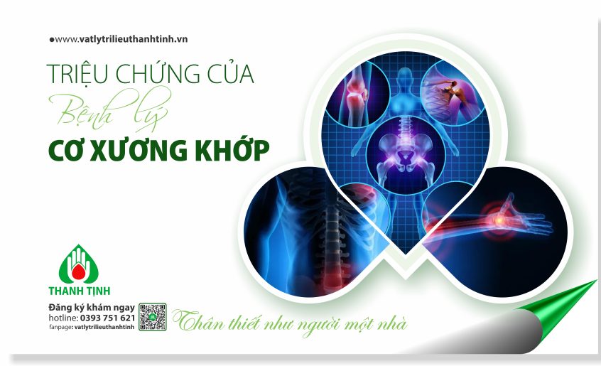 TRIEU CHUNG BENH LY CO XUONG KHOP