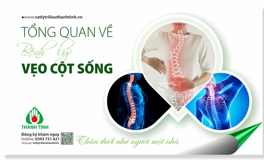 VEO COT SONG