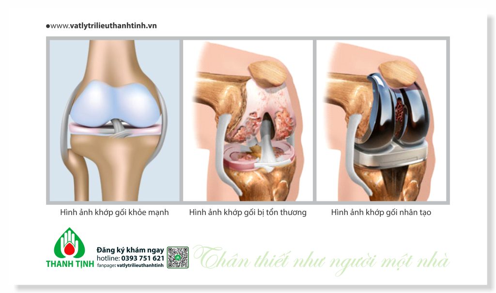 Mô tả chi tiết khớp gối